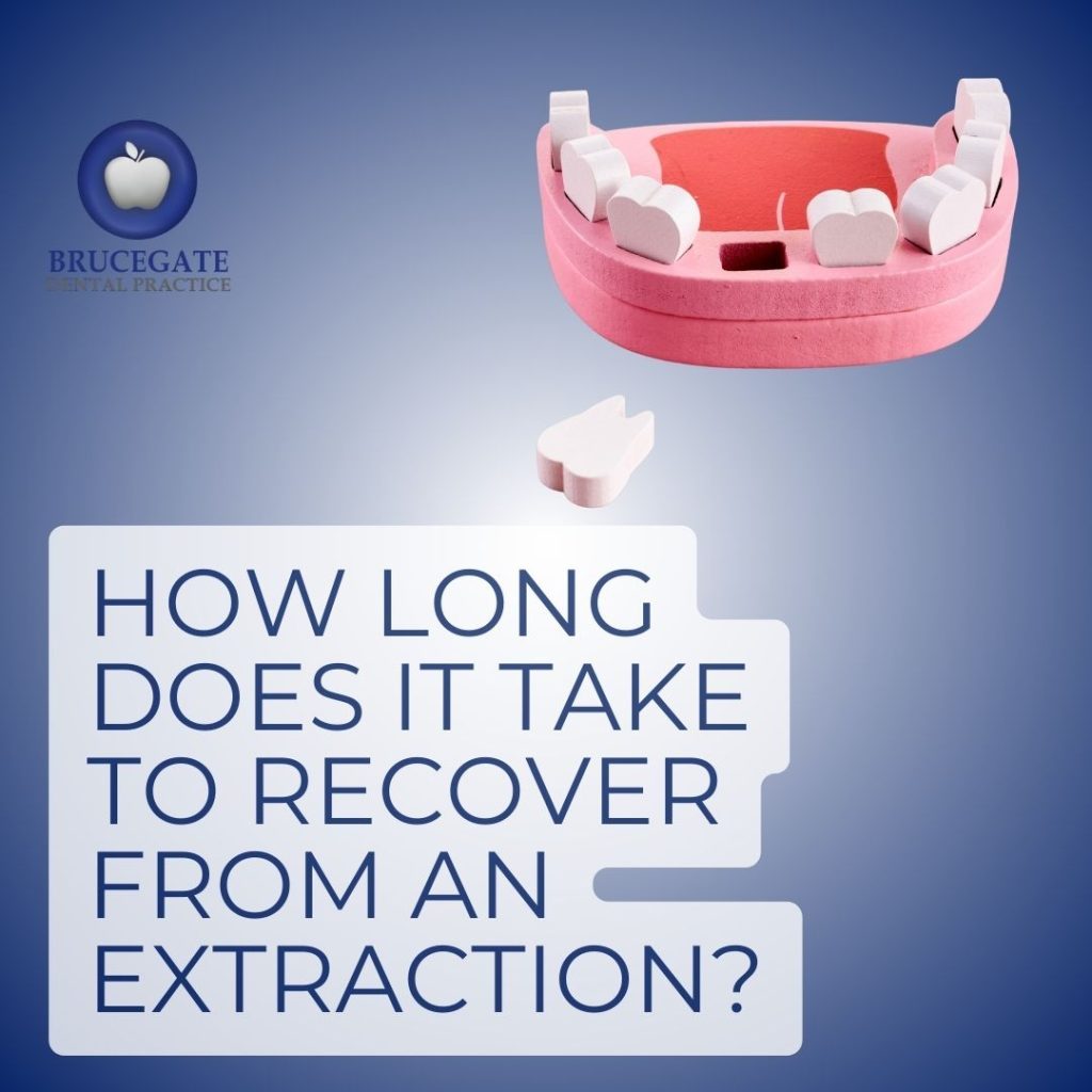 Tooth Extraction