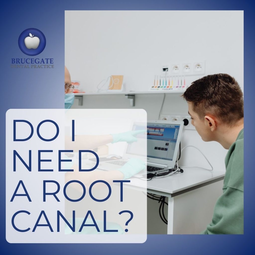Do I need Root Canal