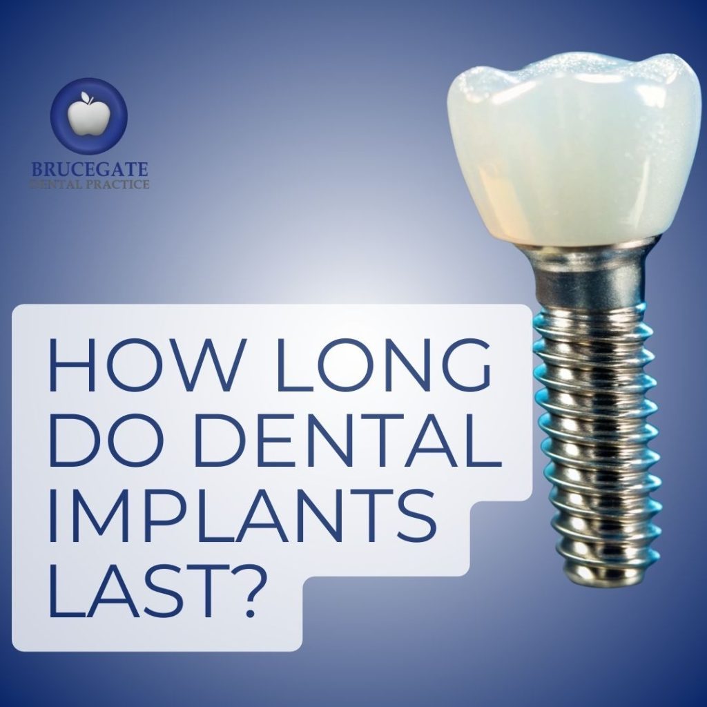 Dental Implants