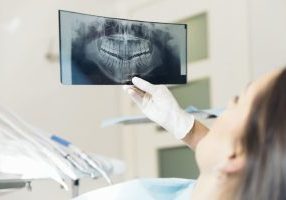 Dentist X-ray