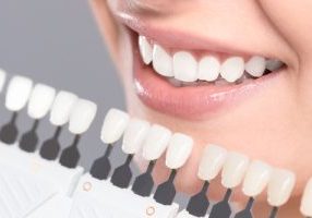 Tooth Whitening