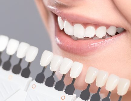 Invisalign Vs Fixed Braces - Brucegate Dental Practice