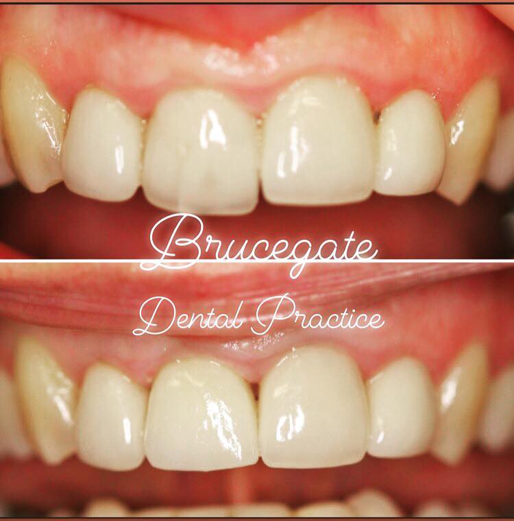 Cosmetic Treatments - Brucegate Dental Practice