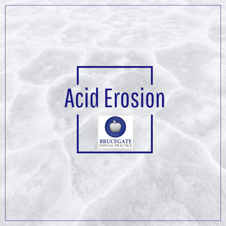 Poster page Acid Erosion Brucegate Dental Practice
