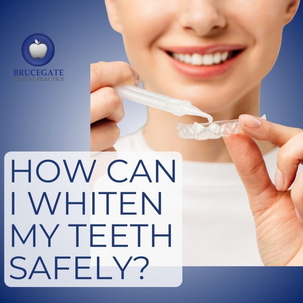 Tooth Whitening Safely