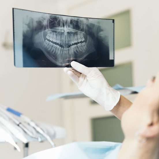 Dentist X-ray