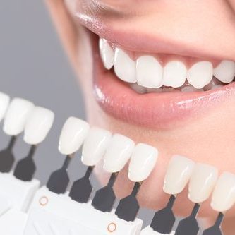 Tooth Whitening